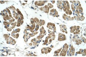 Immunohistochemistry (IHC) image for anti-Ras Homolog Gene Family, Member T1 (RHOT1) (N-Term) antibody (ABIN2782020)