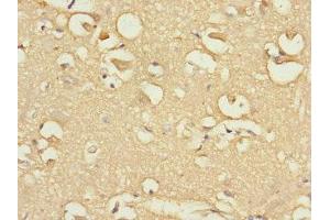 Immunohistochemistry of paraffin-embedded human brain tissue using ABIN7152437 at dilution of 1:100 (FBXO4 抗体  (AA 138-387))