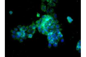 Image provided by One World Lab validation program. (Cathepsin L 抗体  (AA 71-170))