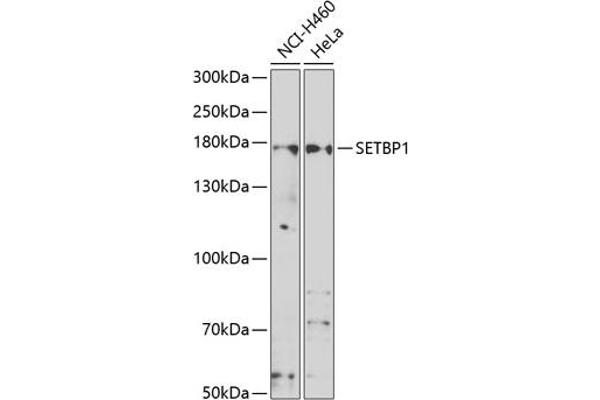 SETBP1 抗体  (AA 1-242)