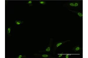 Immunofluorescence of monoclonal antibody to STK24 on HeLa cell. (STK24 抗体  (AA 1-431))