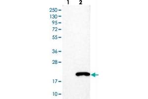 Western blot analysis of Lane 1: Negative control (vector only transfected HEK293T lysate). (LGALS7 抗体)