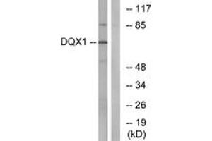 Western blot analysis of extracts from COS7 cells, using DQX1 Antibody. (DQX1 抗体  (AA 551-600))