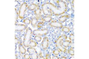 Immunohistochemistry of paraffin-embedded rat kidney using WRB antibody (ABIN5974453) at dilution of 1/200 (40x lens). (WRB 抗体)