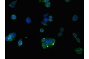 Immunofluorescent analysis of HepG2 cells using ABIN7166981 at dilution of 1:100 and Alexa Fluor 488-congugated AffiniPure Goat Anti-Rabbit IgG(H+L) (RAB3IP 抗体  (AA 1-132))