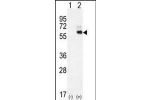 Western blot analysis of KNG1 (arrow) using rabbit polyclonal KNG1 Antibody (N-term) (ABIN655629 and ABIN2845108). (KNG1 抗体  (N-Term))