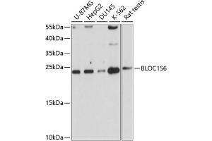 Western blot analysis of extracts of various cell lines, using BLOC1S6 antibody (ABIN1682201, ABIN3019101, ABIN3019102 and ABIN6220714) at 1:1000 dilution. (Pallidin 抗体  (AA 1-170))