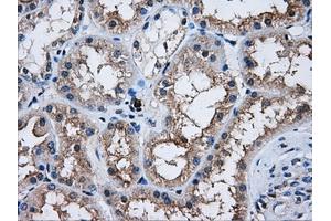 Immunohistochemical staining of paraffin-embedded Kidney tissue using anti-AKT2mouse monoclonal antibody. (AKT2 抗体)