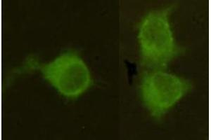 Immunocytochemistry stain of Hela using Mannose Phosphate Isomerase mouse mAb (1:300). (MPI 抗体)