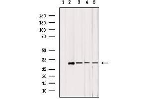Western blot analysis of extracts from various samples, using MRPL2 Antibody.