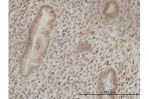 Immunostaining (ISt) image for anti-Cleavage Stimulation Factor, 3' Pre-RNA, Subunit 2, 64kDa (CSTF2) (AA 1-577) antibody (ABIN560511)