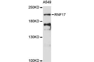 Western blot analysis of extracts of A-549 cells, using RNF17 antibody (ABIN6291205) at 1:3000 dilution. (RNF17 抗体)