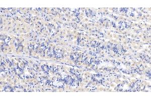 Detection of ASPH in Human Stomach Tissue using Polyclonal Antibody to Aspartate Beta Hydroxylase (ASPH) (Aspartate beta Hydroxylase 抗体  (AA 345-758))