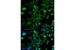 Immunofluorescence analysis of A549 cells using PRDM5 antibody (ABIN5975510). (PRDM5 抗体)