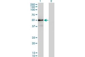Western Blot analysis of SMAD3 expression in transfected 293T cell line by SMAD3 monoclonal antibody (M20), clone 4F9. (SMAD3 抗体  (AA 147-270))