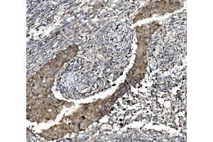 IHC analysis of Claudin 3/CLDN3 using anti-Claudin 3/CLDN3 antibody (ABIN7599626). (Claudin 3 抗体  (AA 101-220))