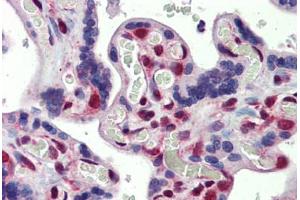 Placenta, Human: Formalin-Fixed, Paraffin-Embedded (FFPE) (FUBP3 抗体  (AA 503-552))
