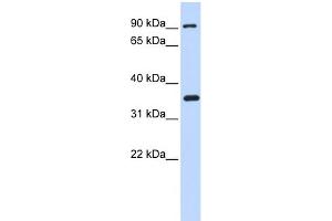 WB Suggested Anti-IKBKB Antibody Titration: 0. (IKBKB 抗体  (N-Term))