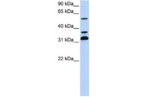 Western Blotting (WB) image for anti-Tripartite Motif Containing 9 (TRIM9) antibody (ABIN2458110) (TRIM9 抗体)