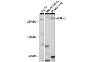 Western blot analysis of extracts of various cell lines, using LRRK2 Polyclonal Antibody  at 1:1000 dilution. (LRRK2 抗体  (AA 2355-2527))