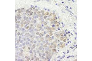 Immunohistochemistry (IHC) image for anti-GATA Zinc Finger Domain Containing 2B (GATAD2B) (AA 50-100) antibody (ABIN7448709)