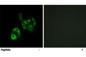 Immunofluorescence analysis of A-549 cells, using SLC27A4 polyclonal antibody . (SLC27A4 抗体)