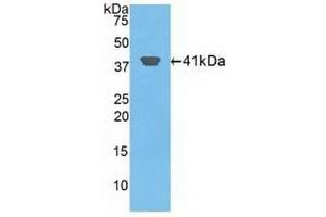 Detection of Recombinant HIST2H2AA3, Human using Polyclonal Antibody to Histone Cluster 2, H2aa3 (HIST2H2AA3) (HIST2H2AA3 抗体  (AA 1-130))