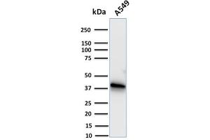 Western Blot Analysis of human A549 cell lysate using Annexin A1 Mouse Monoclonal Antibody (CPTC-ANXA1-1). (Annexin a1 抗体)