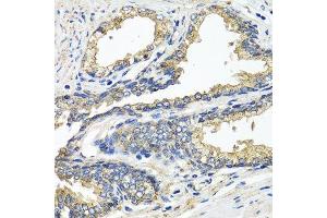 Immunohistochemistry (Paraffin-embedded Sections) (IHC (p)) image for anti-Electron-Transfer-Flavoprotein, alpha Polypeptide (ETFA) (AA 1-333) antibody (ABIN6140315)