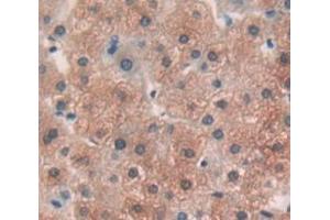 IHC-P analysis of Human Tissue, with DAB staining. (ODC1 抗体  (AA 234-453))