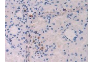 Used in DAB staining on fromalin fixed paraffin- embedded kidney tissue (IL-18 抗体  (AA 37-193))