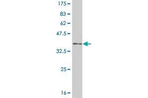 Western Blot detection against Immunogen (35. (NFKBIB 抗体  (AA 56-145))