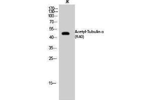 Western Blotting (WB) image for anti-alpha Tubulin (TUBA1) (acLys40) antibody (ABIN3172844) (alpha Tubulin 抗体  (acLys40))
