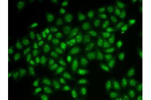 Immunofluorescence analysis of HeLa cells using COIL antibody. (Coilin 抗体  (AA 297-576))