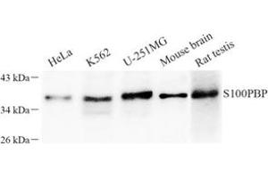 Western blot analysis of S100PBP (ABIN7075500) at dilution of 1: 100 (S100PBP 抗体)