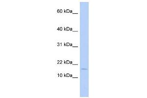 WB Suggested Anti-ISCA2 Antibody Titration: 0. (ISCA2 抗体  (Middle Region))