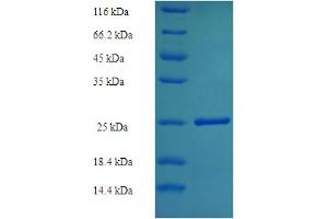 SDS-PAGE (SDS) image for Vasohibin 1 (VASH1) (AA 1-204) protein (His tag) (ABIN5711437) (VASH1 Protein (AA 1-204) (His tag))