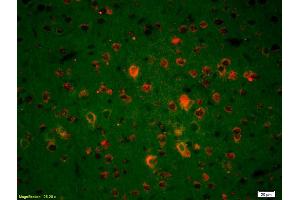 Formalin-fixed and paraffin-embedded rat brain labeled with Anti-Endo G Polyclonal Antibody, Unconjugated (ABIN680893) 1:200, overnight at 4°C, The secondary antibody was Goat Anti-Rabbit IgG, Cy3 conjugated used at 1:200 dilution for 40 minutes at 37°C. (Endonuclease G 抗体  (AA 101-200))
