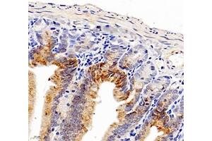 Immunohistochemistry (Paraffin-embedded Sections) (IHC (p)) image for anti-Aldehyde Dehydrogenase 4 Family, Member A1 (ALDH4A1) antibody (ABIN7073000)