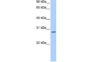 WB Suggested Anti-NRIP3 Antibody Titration:  0. (NRIP3 抗体  (Middle Region))
