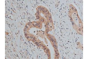 Immunohistochemistry (IHC) image for anti-Proto-oncogene tyrosine-protein kinase Src (Src) (pTyr530) antibody (ABIN6256758)