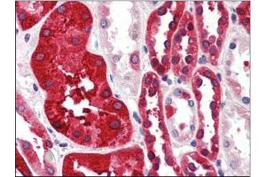 Human Kidney (formalin-fixed, paraffin-embedded) stained with FTH1at 4 µg/ml followed by biotinylated anti-goat IgG secondary antibody, alkaline phosphatase-streptavidin and chromogen. (FTH1 抗体  (C-Term, Heavy Chain))