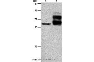Western blot analysis of Jurkat cell and human rectal cancer tissue, using PCSK9 Polyclonal Antibody at dilution of 1:200 (PCSK9 抗体)