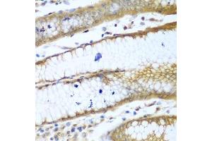Immunohistochemistry of paraffin-embedded human stomach using ROCK1 antibody. (ROCK1 抗体  (AA 400-660))