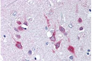 Anti-CACNA1C / Cav1.