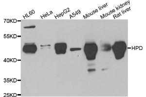 Western blot analysis of extracts of various cell lines, using HPD antibody (ABIN5973894) at 1/1000 dilution. (HPD 抗体)