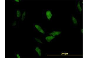 Immunofluorescence of monoclonal antibody to LRRFIP1 on HeLa cell. (LRRFIP1 抗体  (AA 675-784))