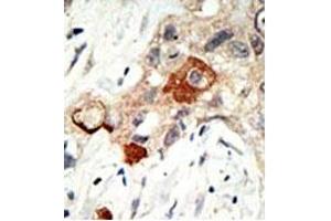 Image no. 1 for anti-Ubiquitin-Conjugating Enzyme E2I (UBE2I) (N-Term) antibody (ABIN356594) (UBE2I 抗体  (N-Term))