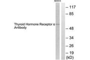 Western Blotting (WB) image for anti-Thyroid Hormone Receptor, alpha (THRA) (AA 10-59) antibody (ABIN2889264) (THRA 抗体  (AA 10-59))