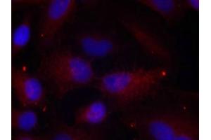 Immunofluorescence staining of methanol-fixed Hela cells using PAK1/PAK2/PAK3(Phospho-Thr423/Thr402/Thr421) Antibody. (PAK1/2/3 抗体  (pThr423))